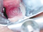 骚母狗少女自慰扩阴往里面扔牛奶刺激